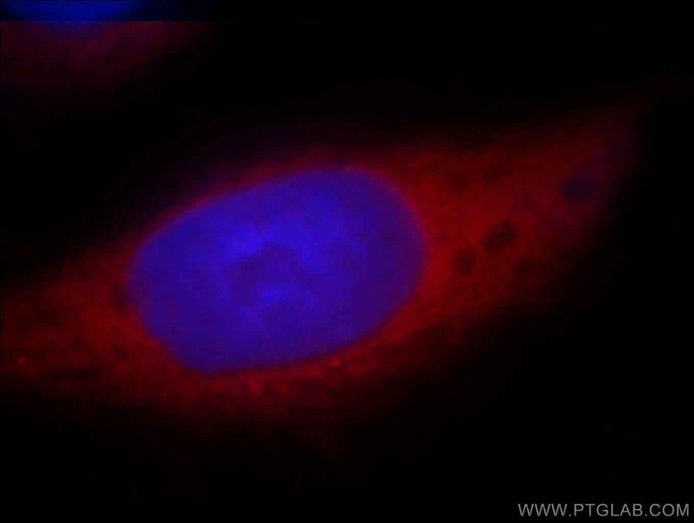 Immunofluorescence (IF) / fluorescent staining of HeLa cells using HMBS Polyclonal antibody (14797-1-AP)