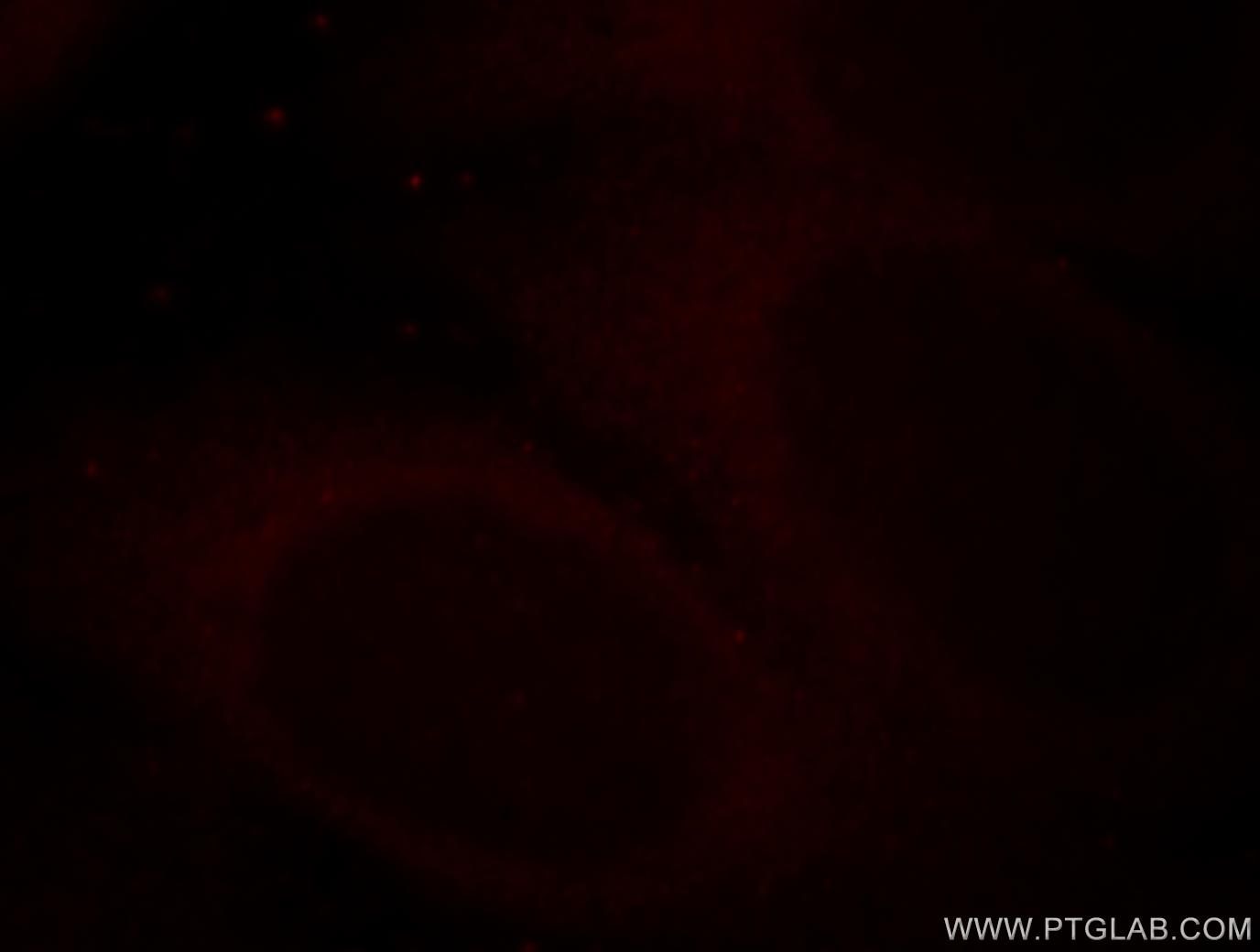 Immunofluorescence (IF) / fluorescent staining of HepG2 cells using HMBS Polyclonal antibody (14797-1-AP)