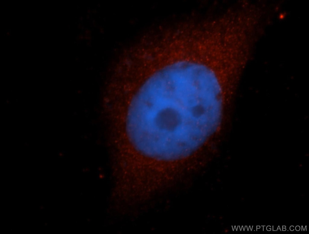 IF Staining of MCF-7 using 14797-1-AP