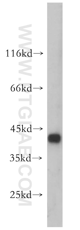 Western Blot (WB) analysis of HeLa cells using HMBS Polyclonal antibody (14797-1-AP)