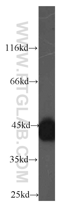 Western Blot (WB) analysis of Raji cells using HMBS Polyclonal antibody (14797-1-AP)