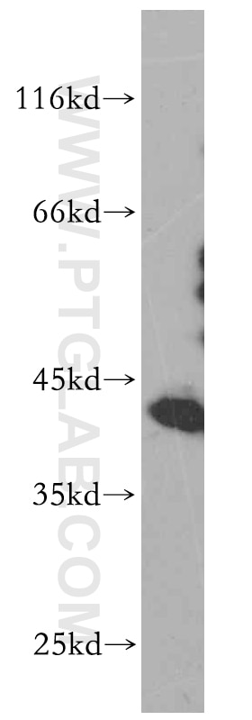 Western Blot (WB) analysis of A375 cells using HMBS Polyclonal antibody (14797-1-AP)