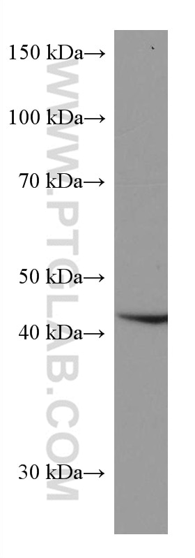 Western Blot (WB) analysis of HeLa cells using HMBS Monoclonal antibody (67456-1-Ig)