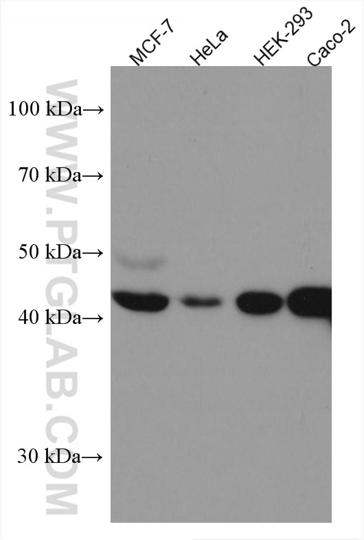 Western Blot (WB) analysis of various lysates using HMBS Monoclonal antibody (67456-1-Ig)