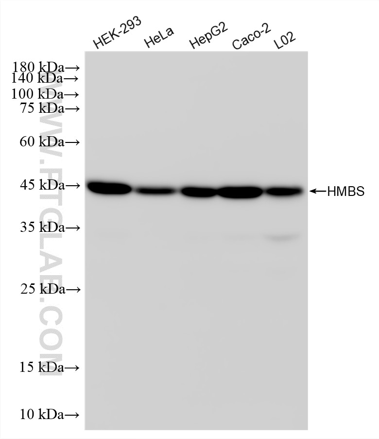Various lysates were subjected to SDS PAGE followed by western blot with 87431-1-RR (HMBS antibody) at dilution of 1:5000 incubated at room temperature for 1.5 hours. This data was developed using the same antibody clone with 87431-1-PBS in a different storage buffer formulation. Western Blot (WB) analysis of various lysates using HMBS Recombinant monoclonal antibody (87431-1-RR)