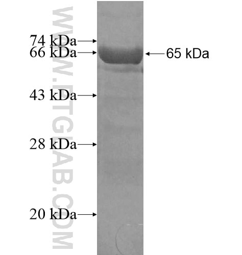 HMBS fusion protein Ag6509 SDS-PAGE