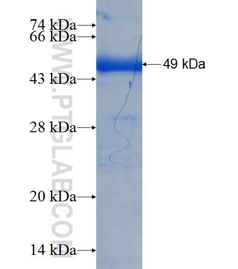 HMBS fusion protein Ag6594 SDS-PAGE
