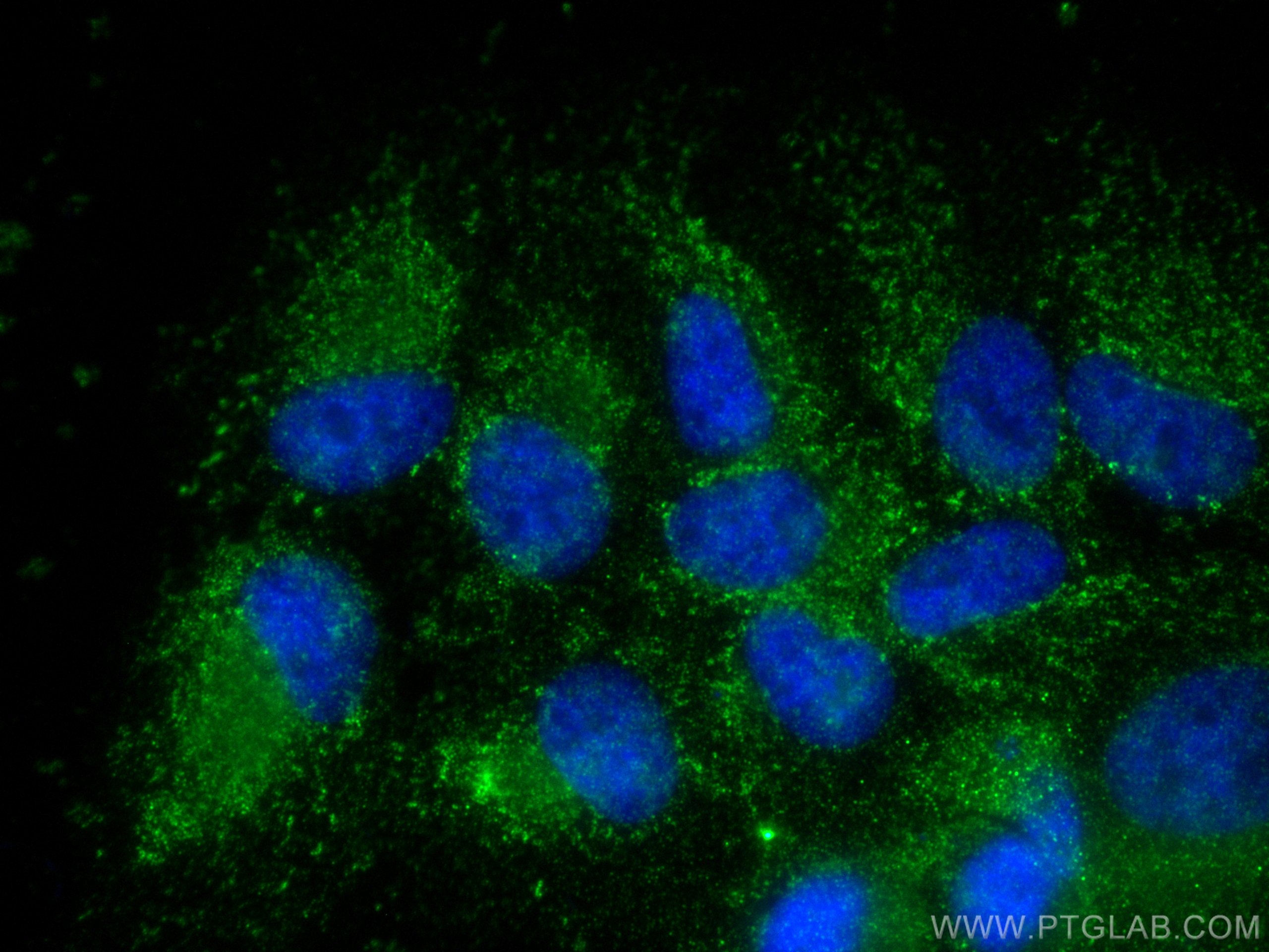 Immunofluorescence (IF) / fluorescent staining of hTERT-RPE1 cells using HMCN1 Polyclonal antibody (18837-1-AP)