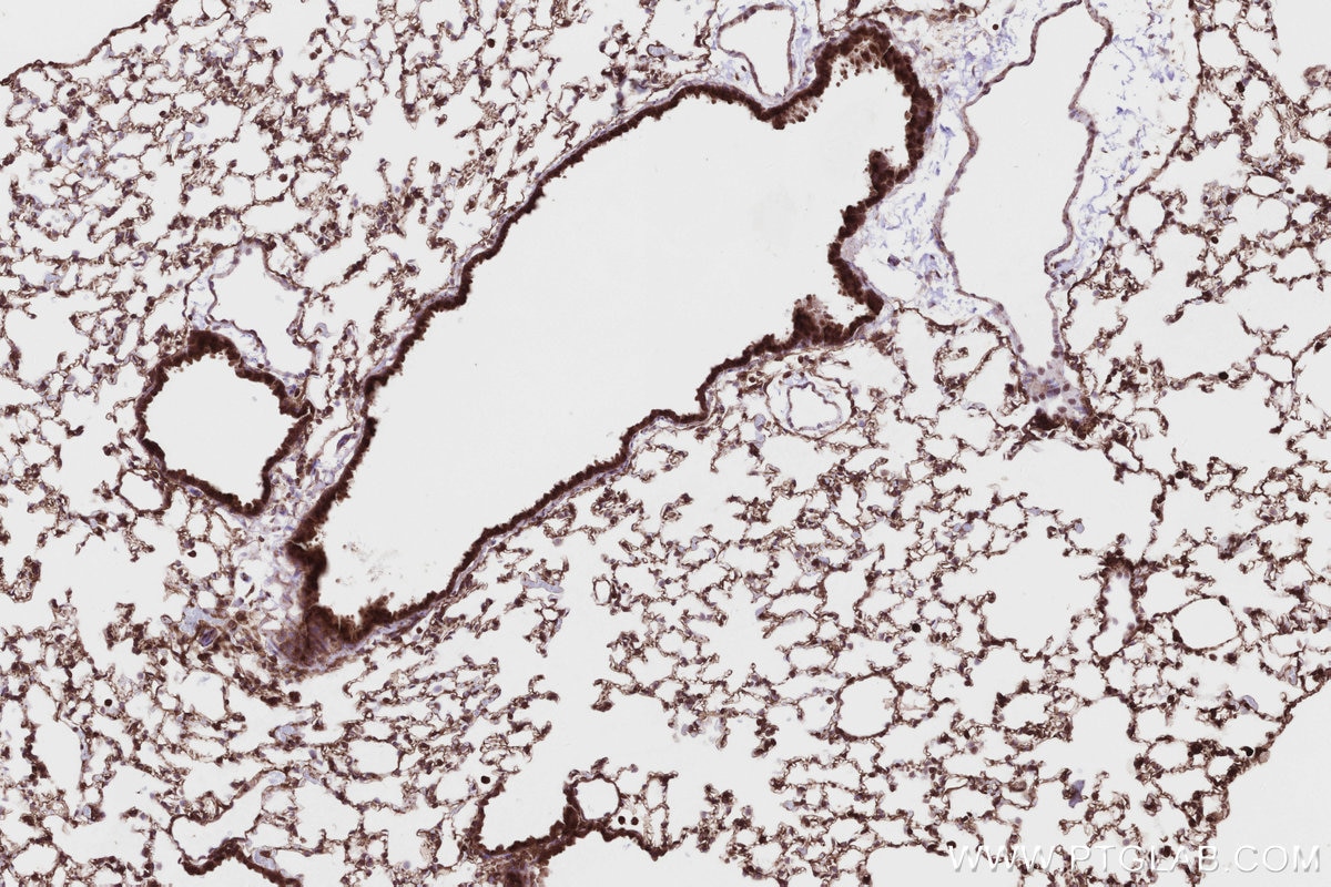 Immunohistochemistry (IHC) staining of mouse lung tissue using HMCN1 Polyclonal antibody (18837-1-AP)