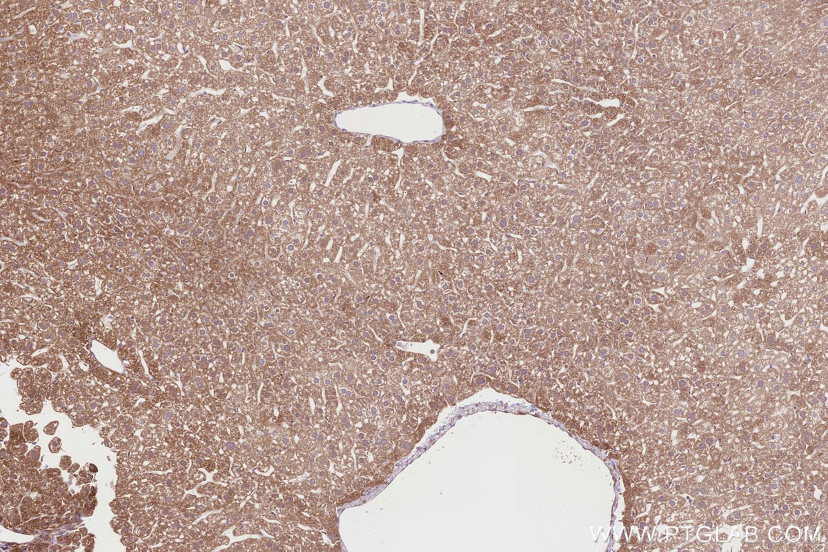 Immunohistochemistry (IHC) staining of mouse liver tissue using HMCN1 Polyclonal antibody (18837-1-AP)