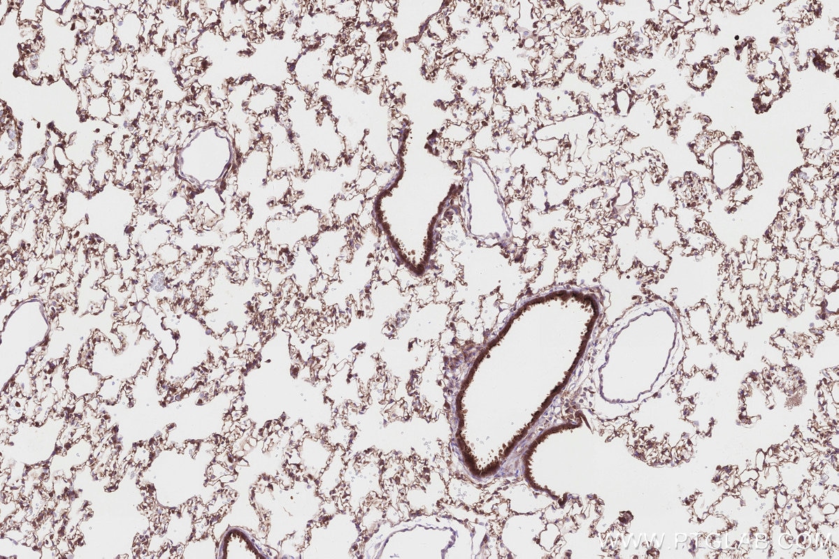 Immunohistochemistry (IHC) staining of rat lung tissue using HMCN1 Polyclonal antibody (18837-1-AP)