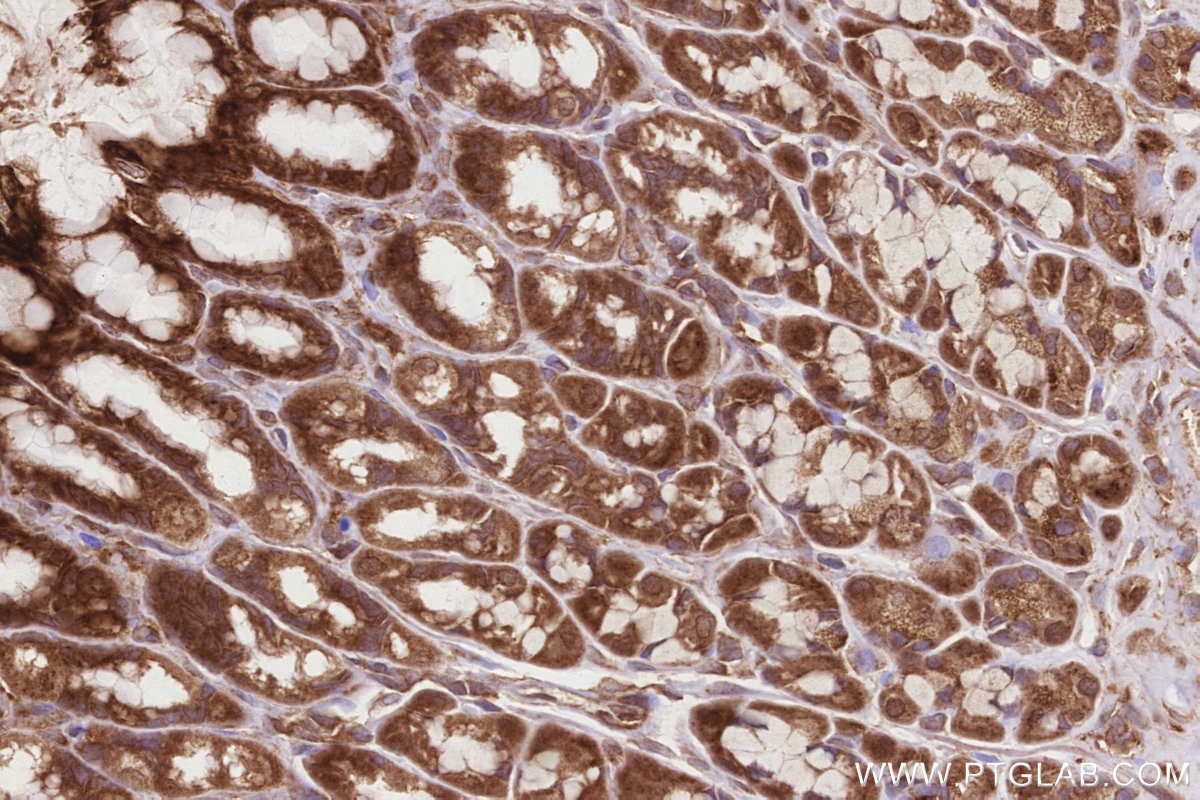 Immunohistochemistry (IHC) staining of rat stomach tissue using HMCN1 Polyclonal antibody (18837-1-AP)