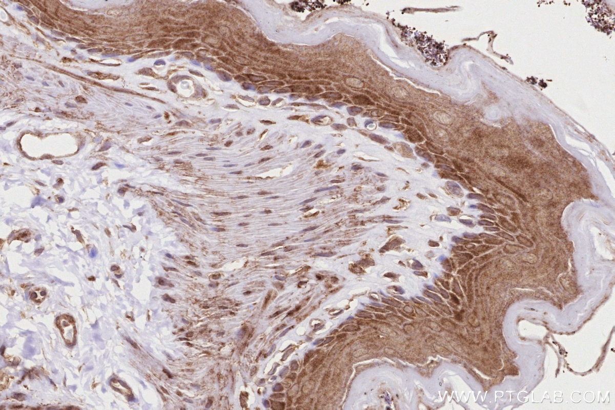 Immunohistochemistry (IHC) staining of rat stomach tissue using HMCN1 Polyclonal antibody (18837-1-AP)