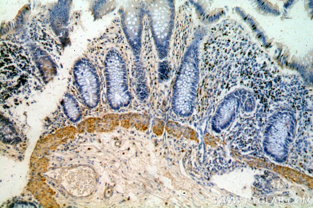 Immunohistochemistry (IHC) staining of human colon tissue using HMCN1 Polyclonal antibody (18837-1-AP)