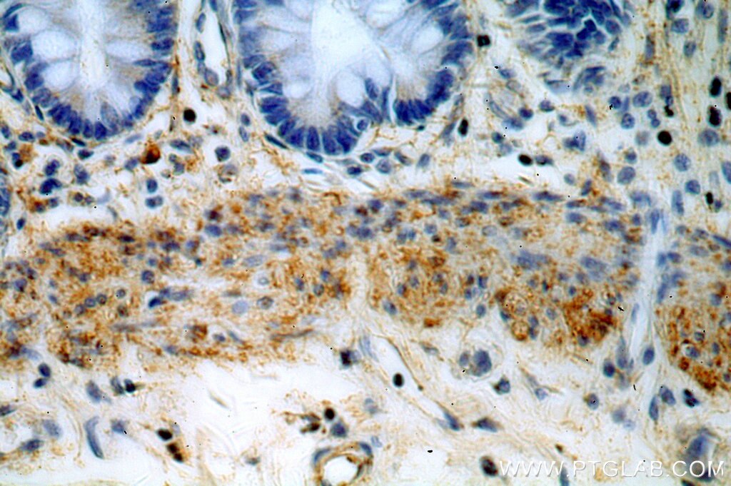 Immunohistochemistry (IHC) staining of human colon tissue using HMCN1 Polyclonal antibody (18837-1-AP)