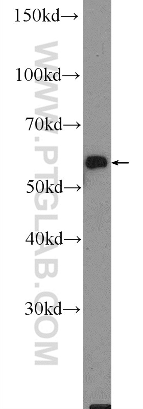 Western Blot (WB) analysis of mouse skin tissue using HMCN1 Polyclonal antibody (18837-1-AP)