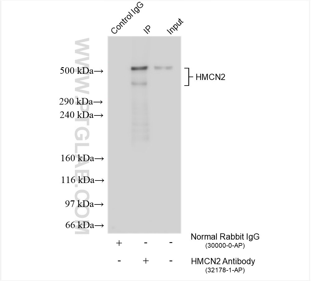 Immunoprecipitation (IP) experiment of SH-SY5Y cells using HMCN2 Polyclonal antibody (32178-1-AP)