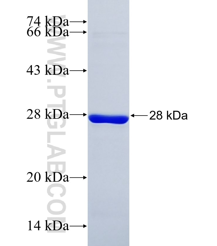 HMCN2 fusion protein Ag37624 SDS-PAGE HMCN2 fusion protein Ag37624 SDS-PAGE