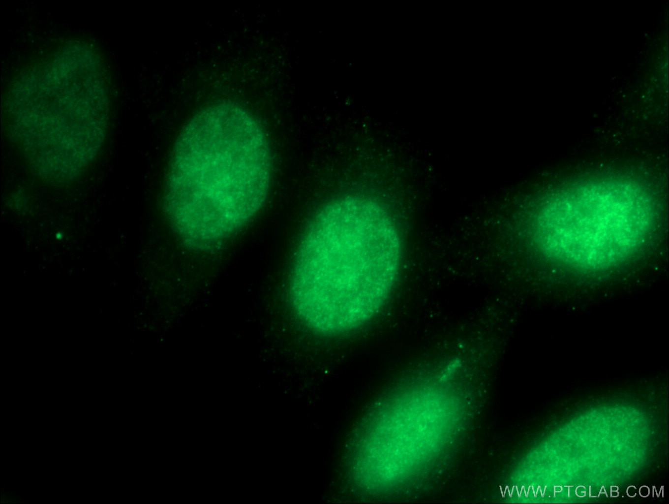 Immunofluorescence (IF) / fluorescent staining of HepG2 cells using HMG20A Polyclonal antibody (12085-2-AP)