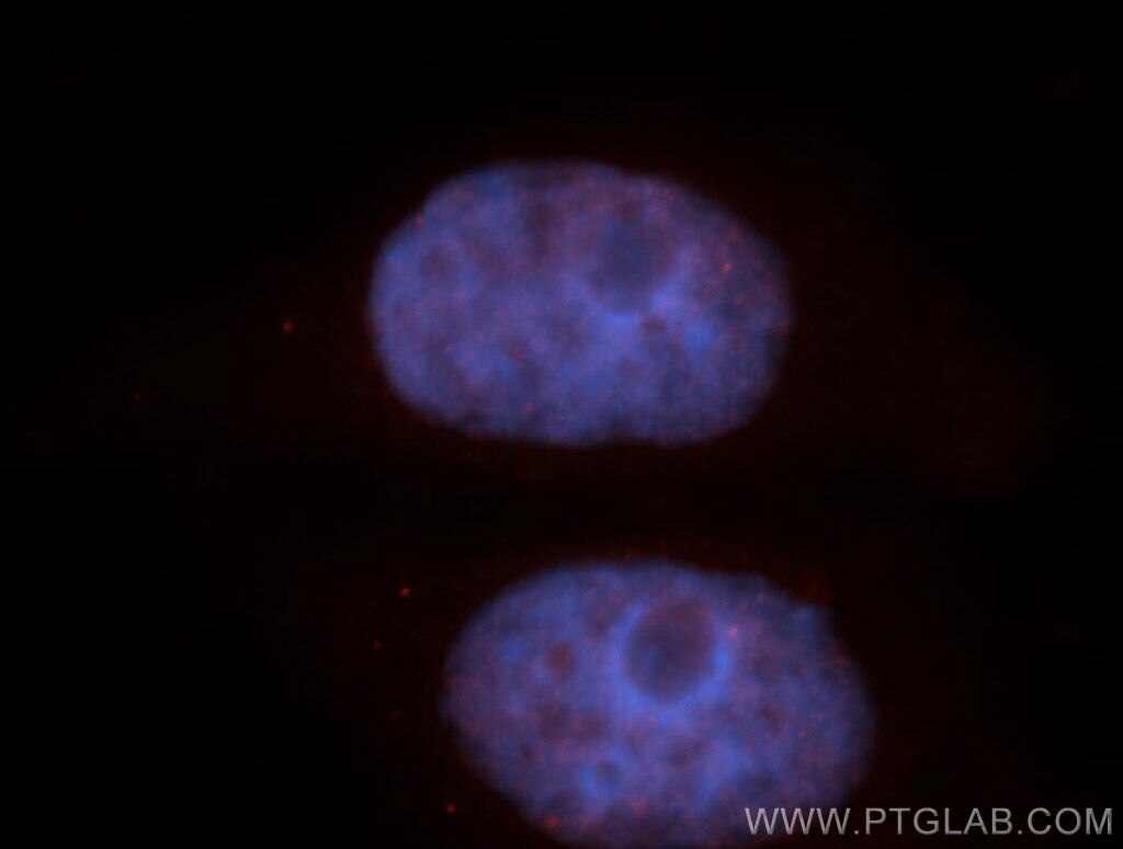 Immunofluorescence (IF) / fluorescent staining of HepG2 cells using HMG20A Polyclonal antibody (12085-2-AP)