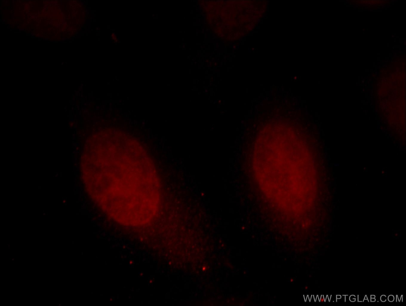 Immunofluorescence (IF) / fluorescent staining of HepG2 cells using HMG20A Polyclonal antibody (12085-2-AP)