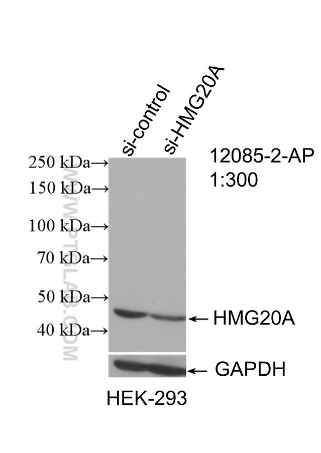 Western Blot (WB) analysis of HEK-293 cells using HMG20A Polyclonal antibody (12085-2-AP)