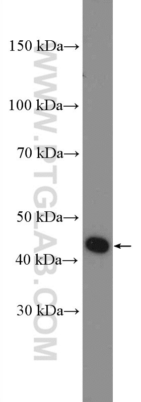 Western Blot (WB) analysis of Jurkat cells using HMG20A Polyclonal antibody (12085-2-AP)