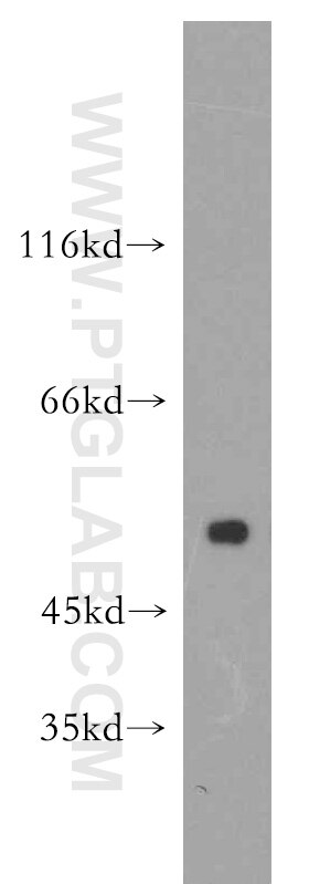 Western Blot (WB) analysis of Jurkat cells using HMG20A Polyclonal antibody (12085-2-AP)