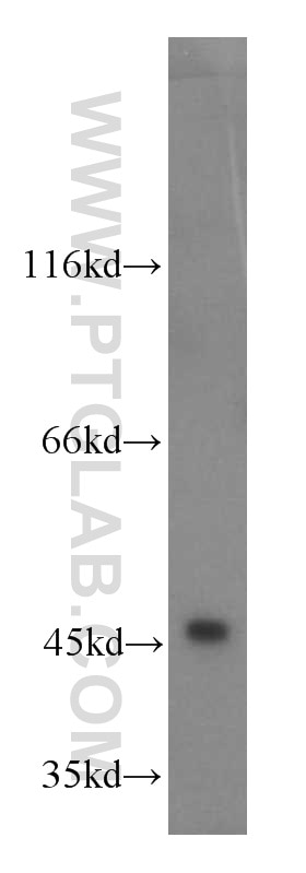 Western Blot (WB) analysis of Jurkat cells using HMG20A Polyclonal antibody (12085-2-AP)