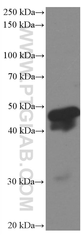 Western Blot (WB) analysis of NCCIT cells using HMG20A Monoclonal antibody (66676-1-Ig)