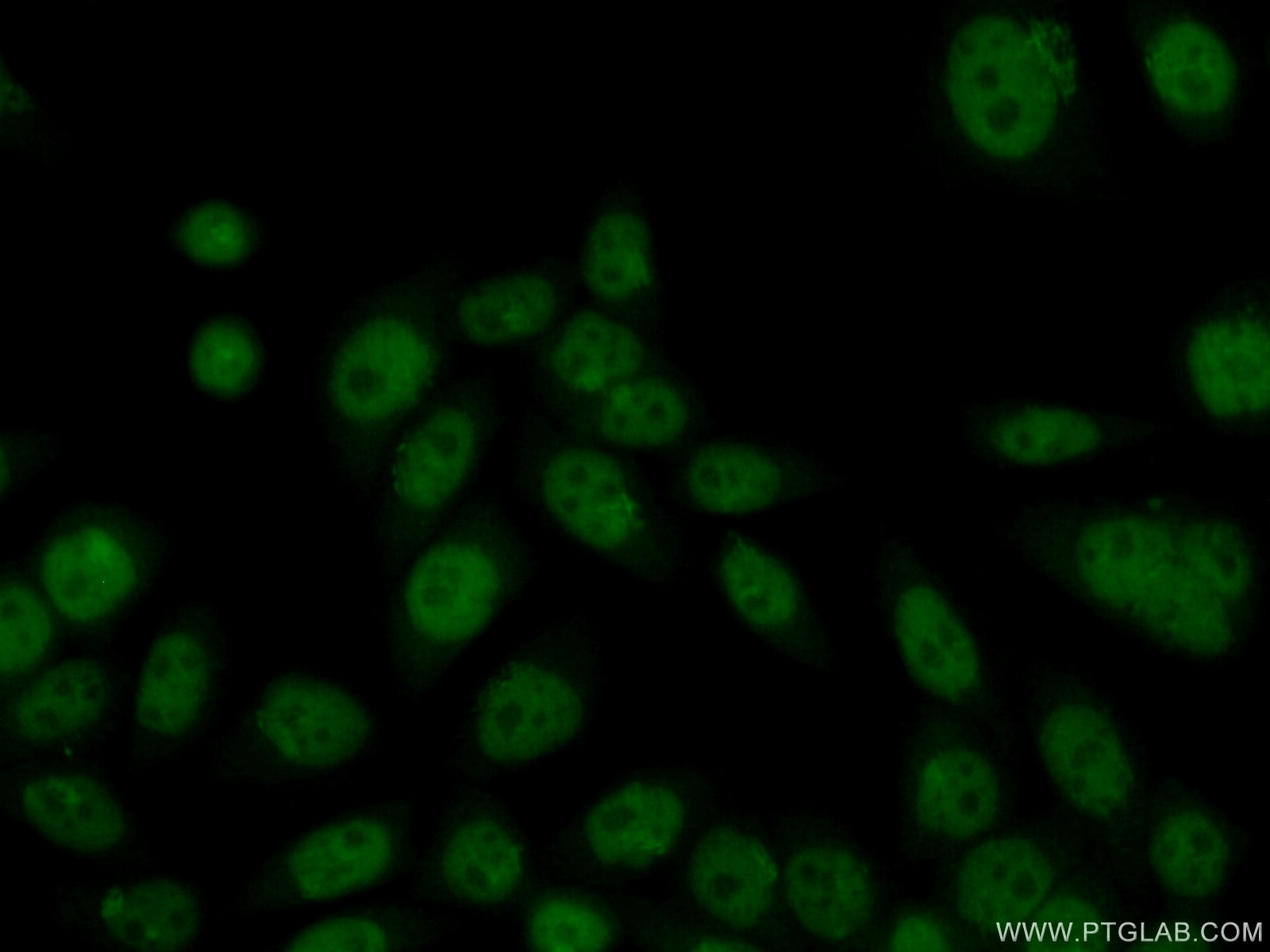 Immunofluorescence (IF) / fluorescent staining of HeLa cells using HMG20B Polyclonal antibody (14582-1-AP)
