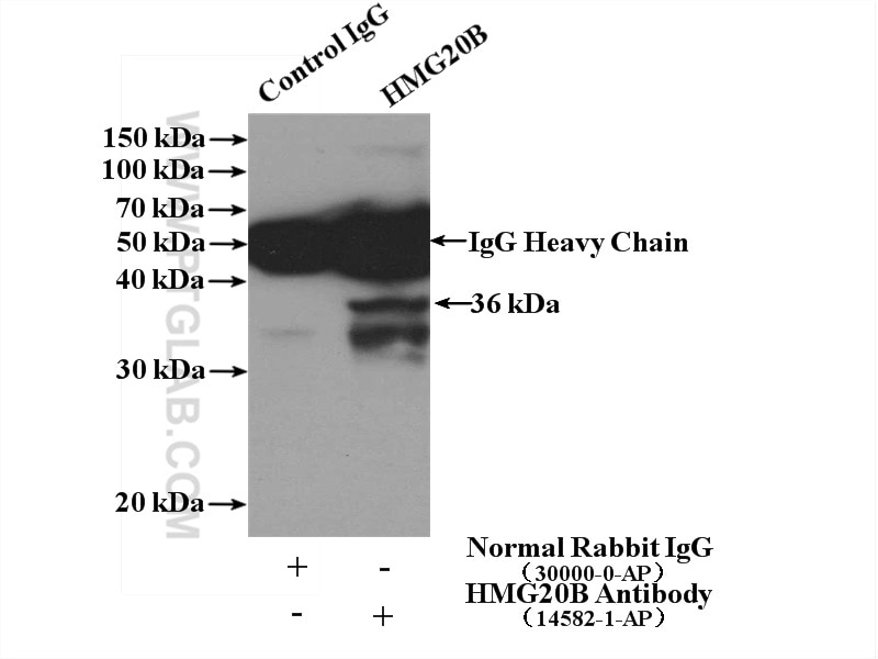 Immunoprecipitation (IP) experiment of HeLa cells using HMG20B Polyclonal antibody (14582-1-AP)