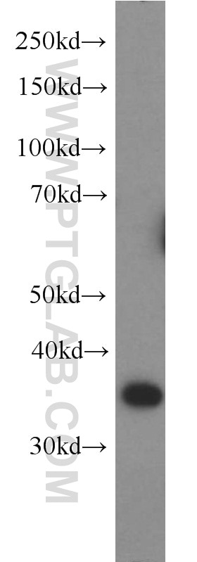 Western Blot (WB) analysis of HeLa cells using HMG20B Polyclonal antibody (14582-1-AP)