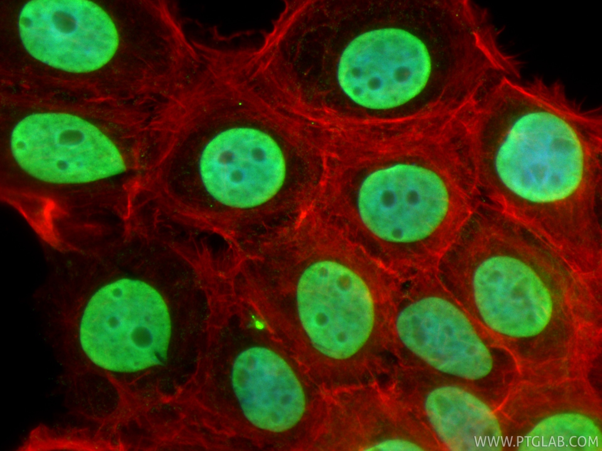 IF Staining of A431 using 29895-1-AP Immunofluorescence (IF) / fluorescent staining of A431 cells using HMGA1 Polyclonal antibody (29895-1-AP)