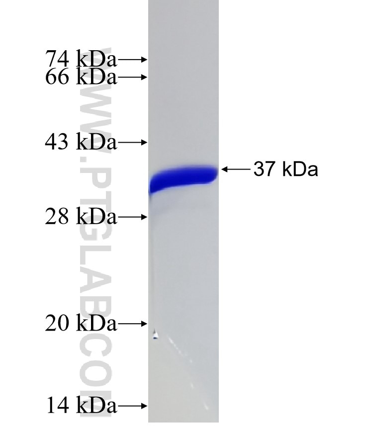 HMGA1 fusion protein Ag31866 SDS-PAGE