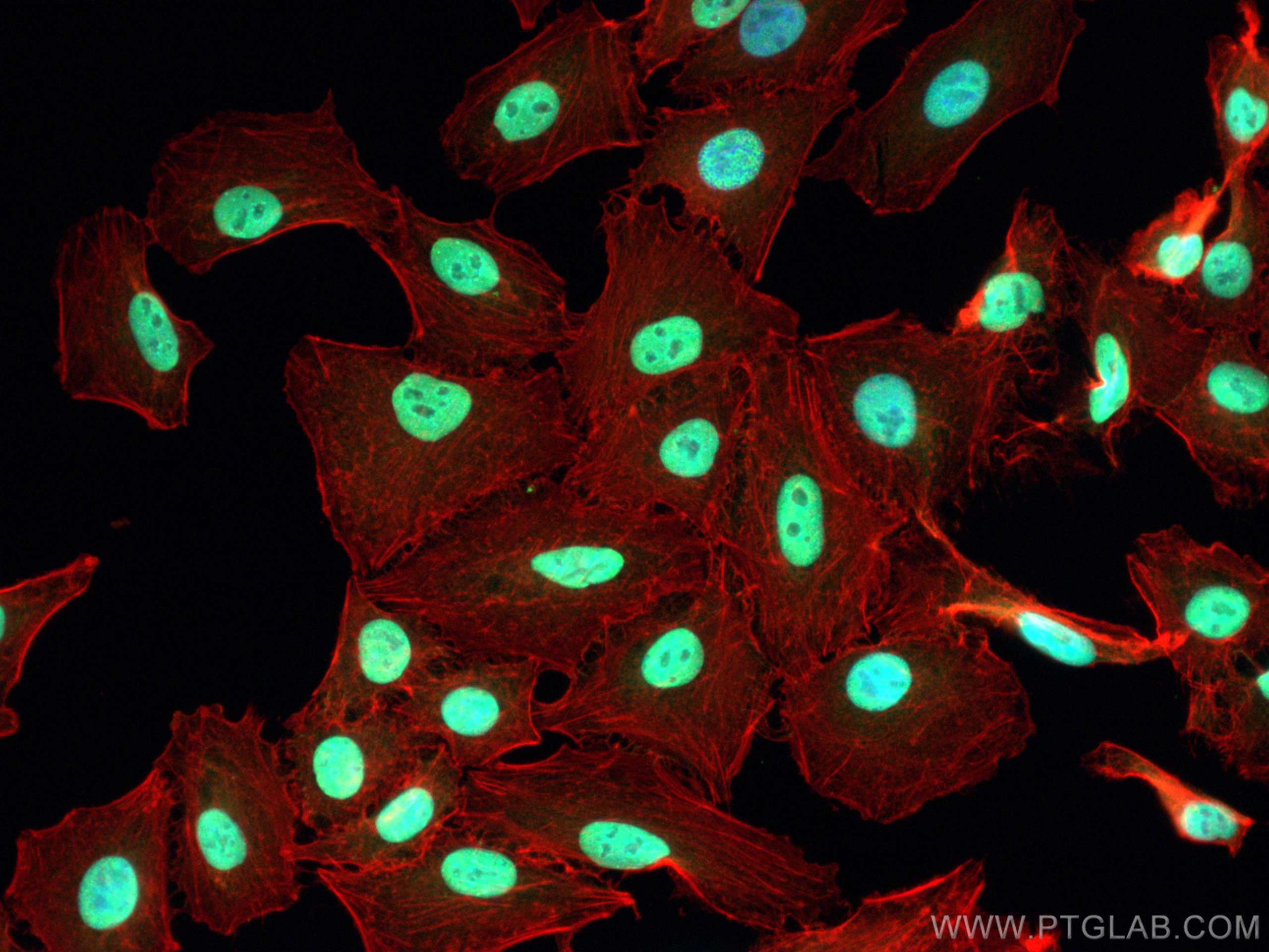 Immunofluorescence (IF) / fluorescent staining of A549 cells using HMGA2 Polyclonal antibody (20795-1-AP)