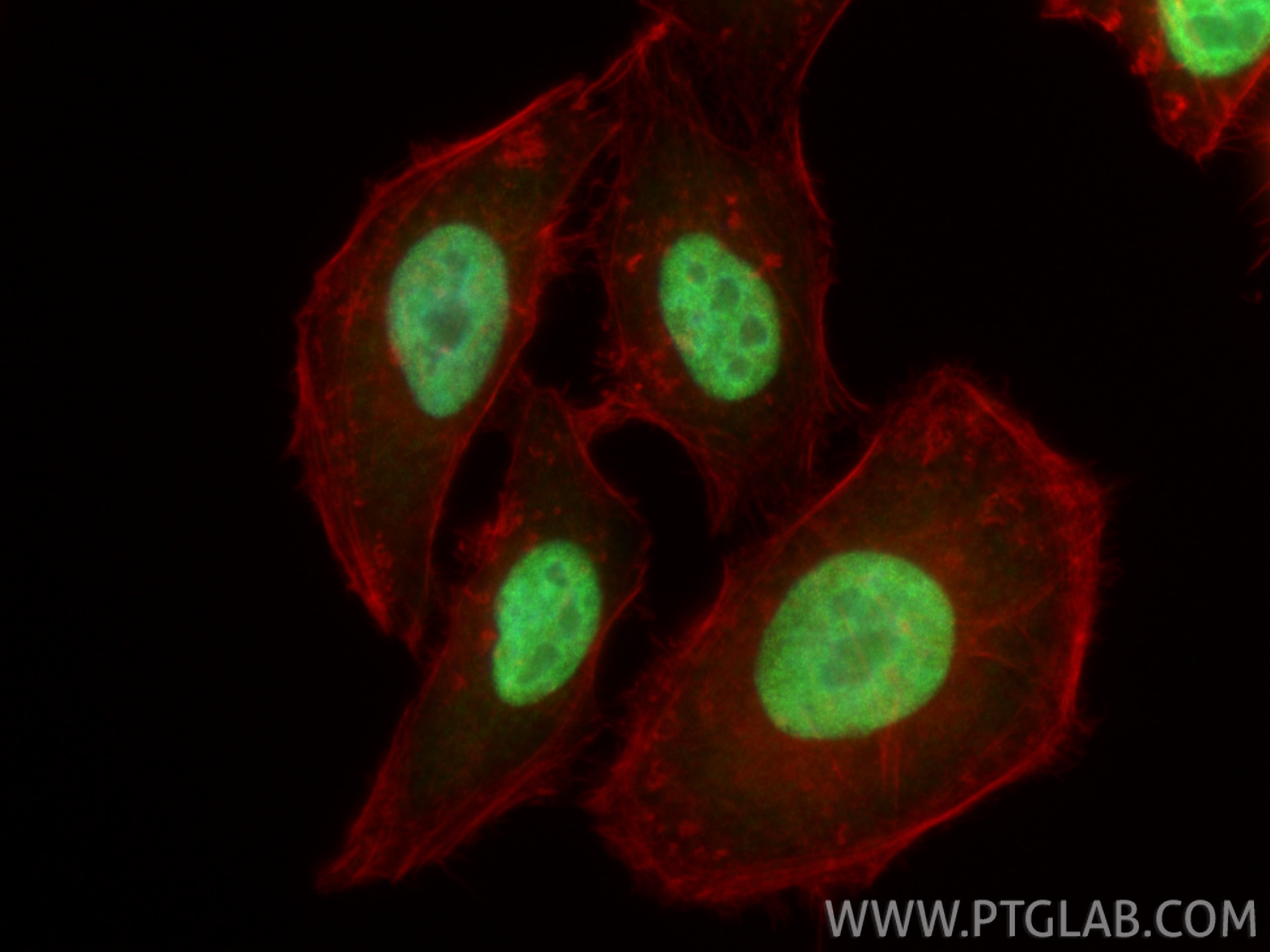IF Staining of HepG2 using 20795-1-AP Immunofluorescence (IF) / fluorescent staining of HepG2 cells using HMGA2 Polyclonal antibody (20795-1-AP)