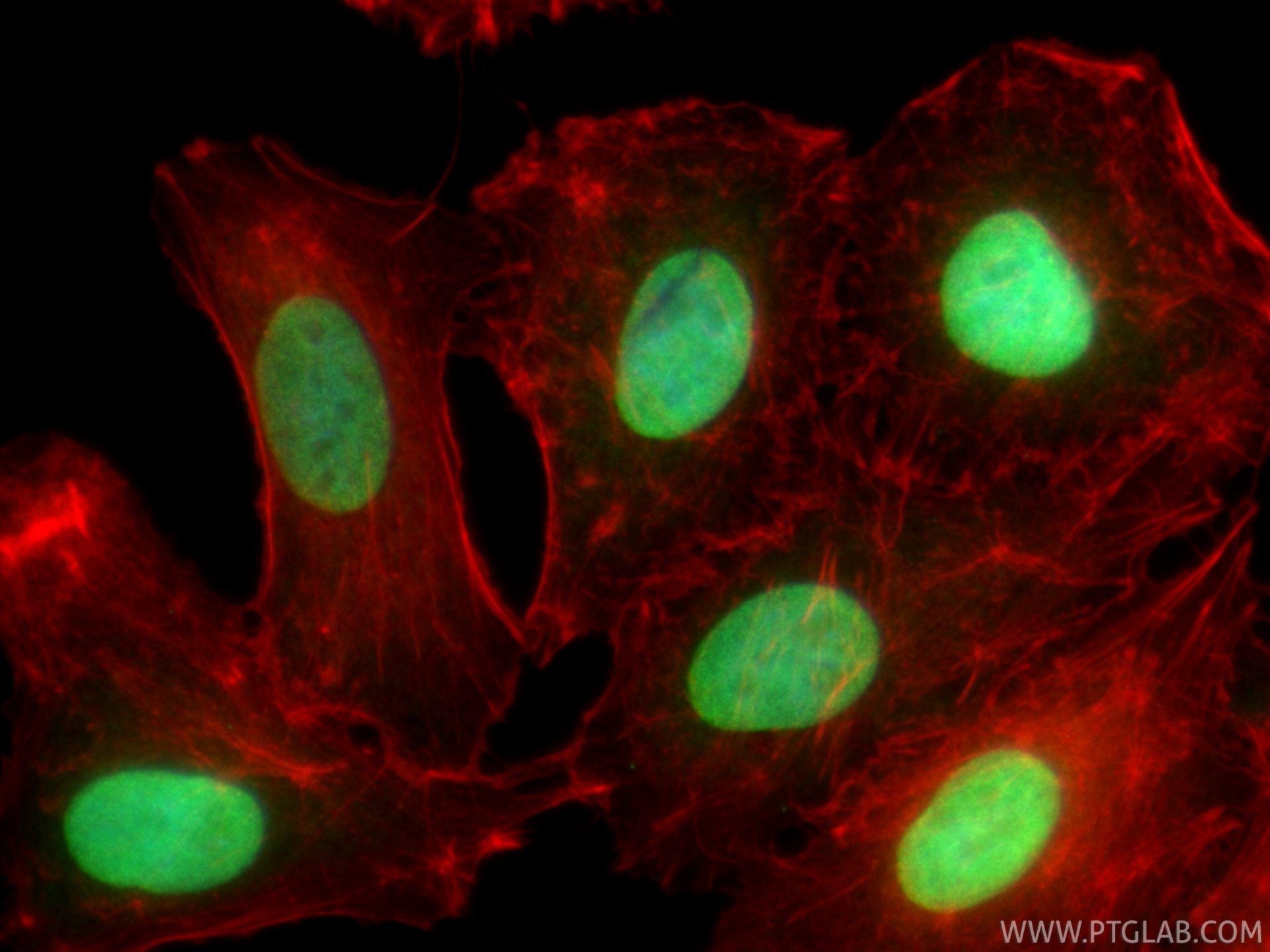 IF Staining of A549 using 20795-1-AP Immunofluorescence (IF) / fluorescent staining of A549 cells using HMGA2 Polyclonal antibody (20795-1-AP)