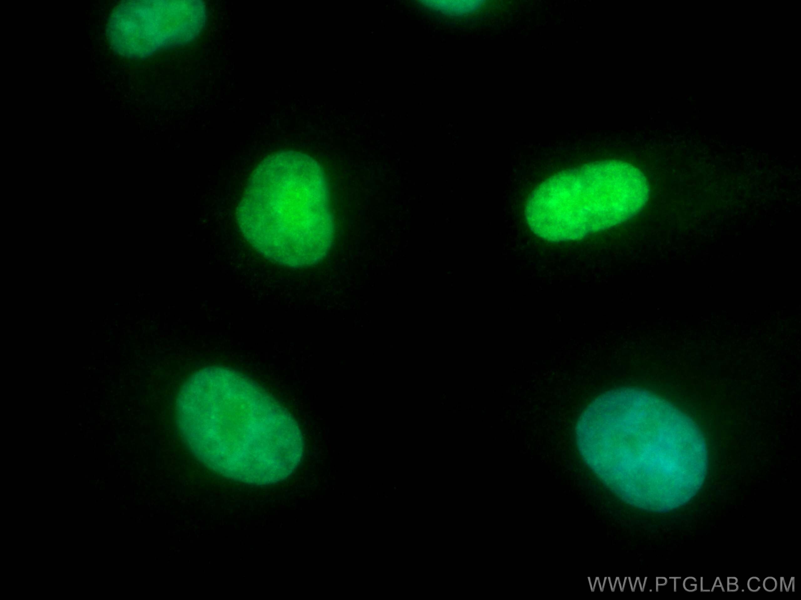 Immunofluorescence (IF) / fluorescent staining of A549 cells using CoraLite® Plus 488-conjugated HMGA2 Polyclonal ant (CL488-20795)
