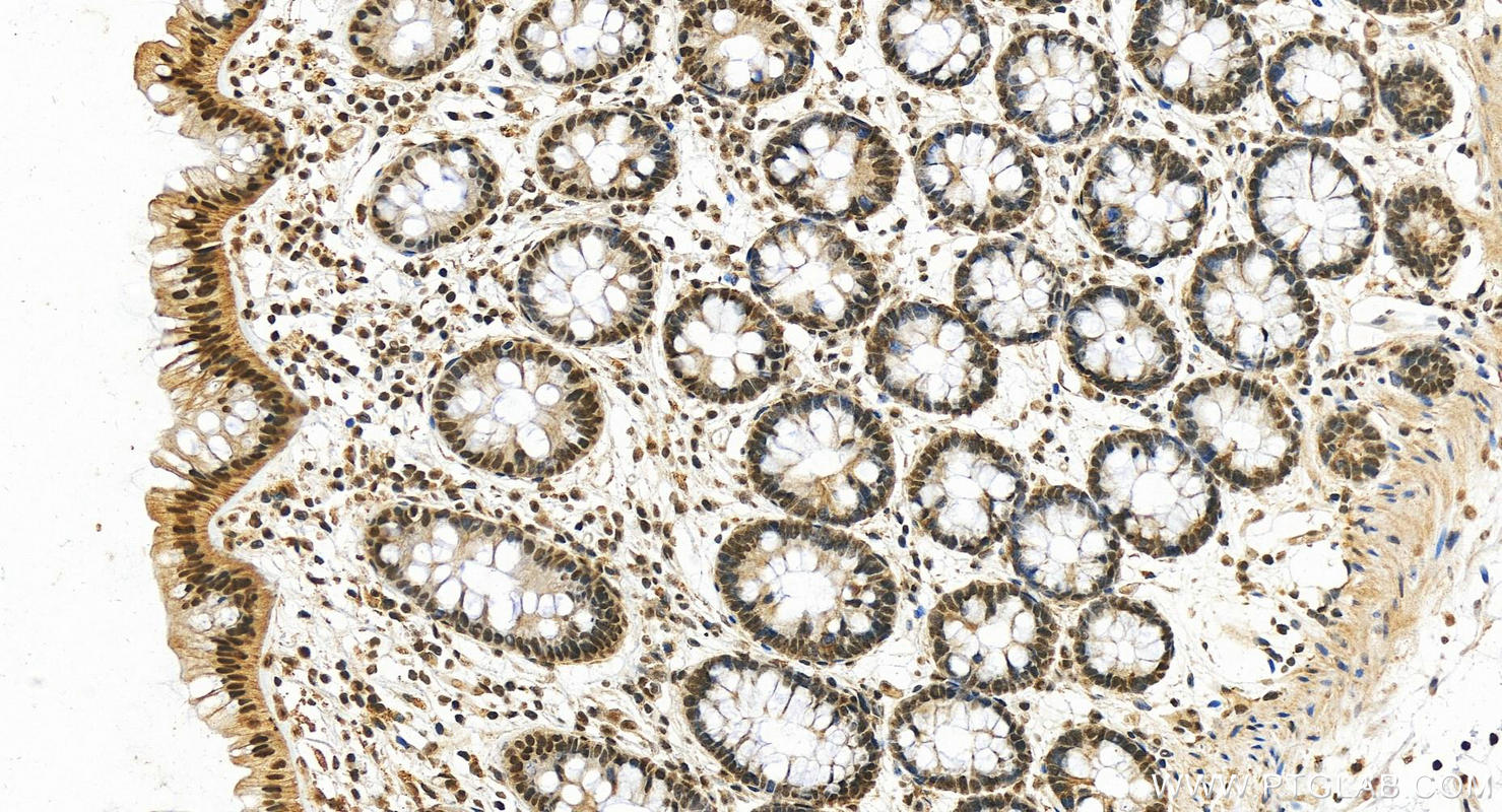 Immunohistochemistry (IHC) staining of human colon tissue using HMGB1 Polyclonal antibody (10829-1-AP)