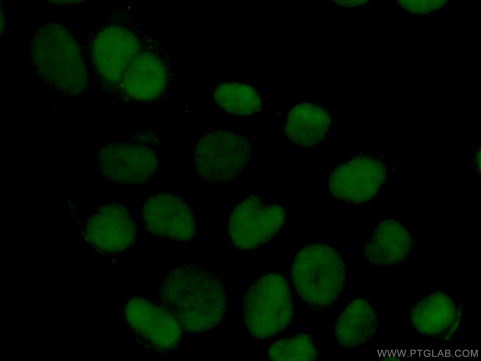 Immunofluorescence (IF) / fluorescent staining of HeLa cells using HMGB1 Polyclonal antibody (10829-1-AP)