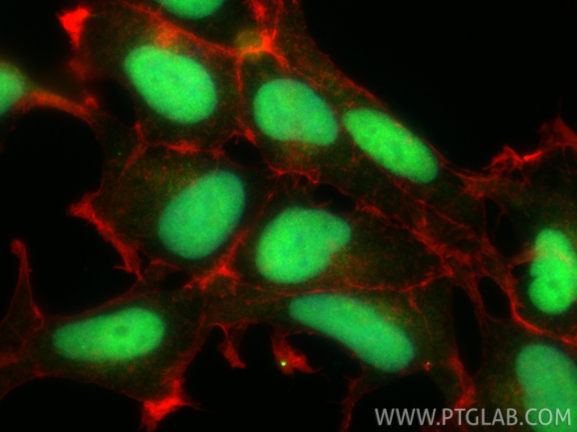 Immunofluorescence (IF) / fluorescent staining of HEK-293 cells using HMGB1 Polyclonal antibody (10829-1-AP)