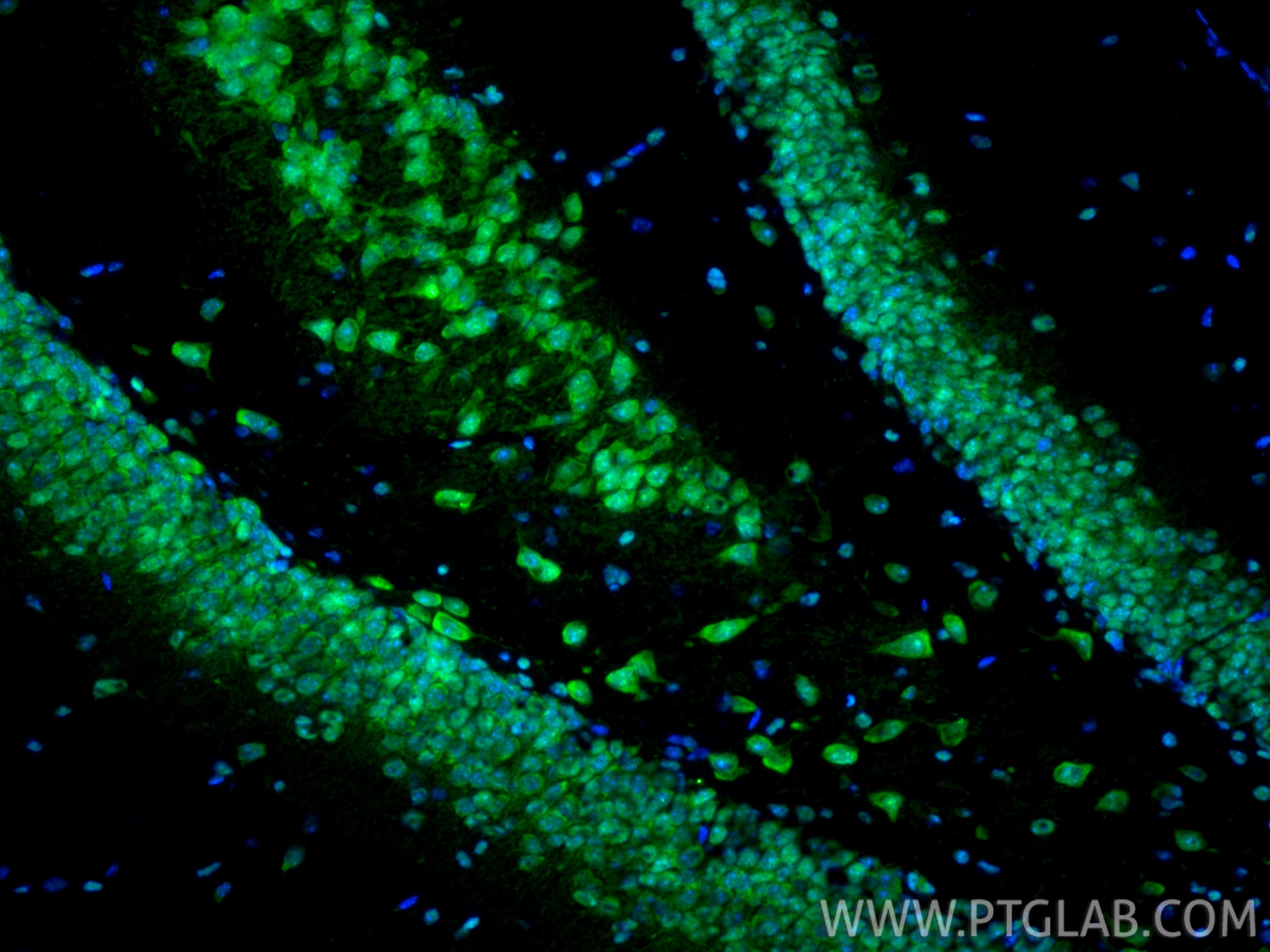 Immunofluorescence (IF) / fluorescent staining of mouse brain tissue using HMGB1 Polyclonal antibody (10829-1-AP)