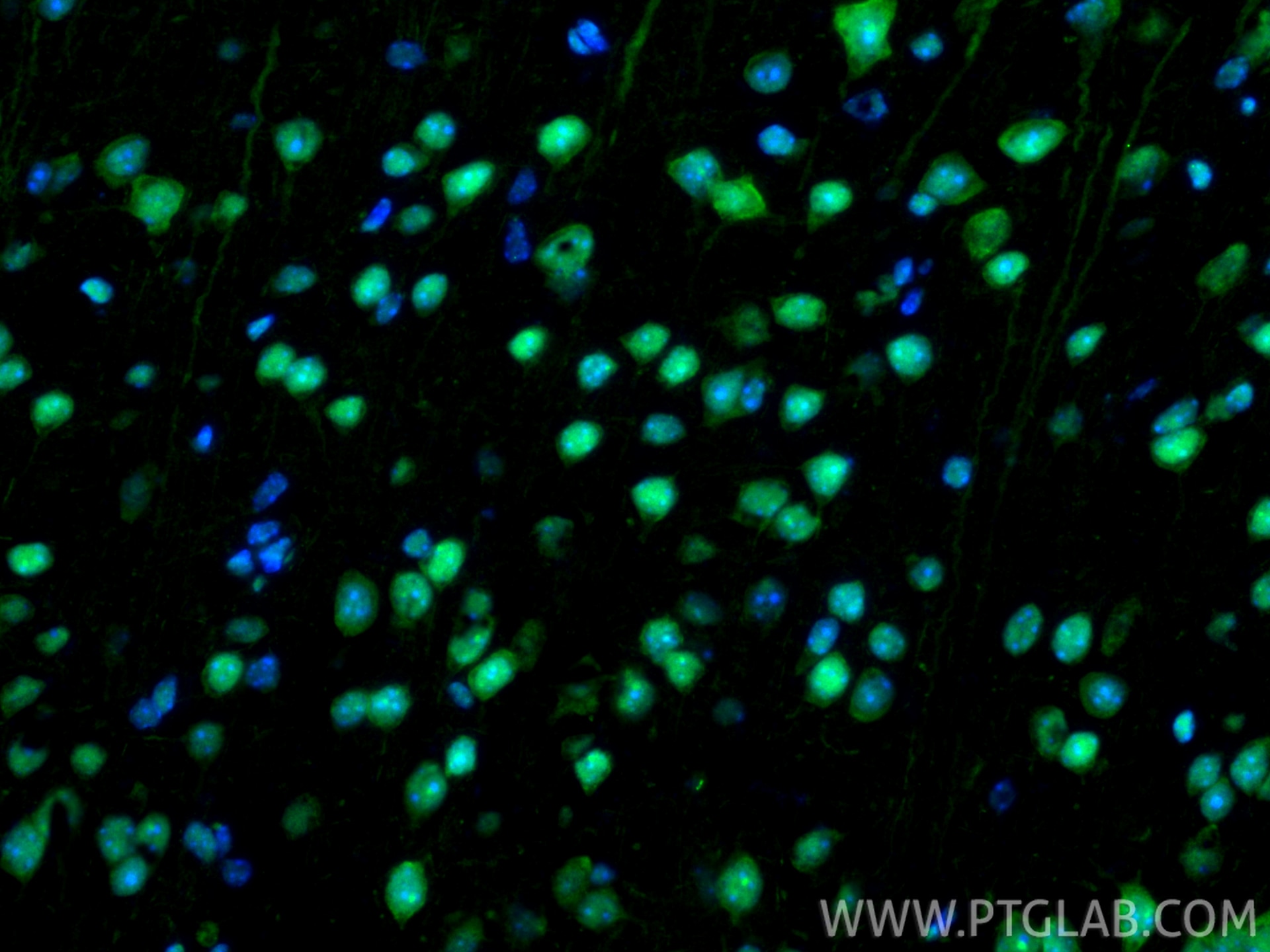 Immunofluorescence (IF) / fluorescent staining of mouse brain tissue using HMGB1 Polyclonal antibody (10829-1-AP)