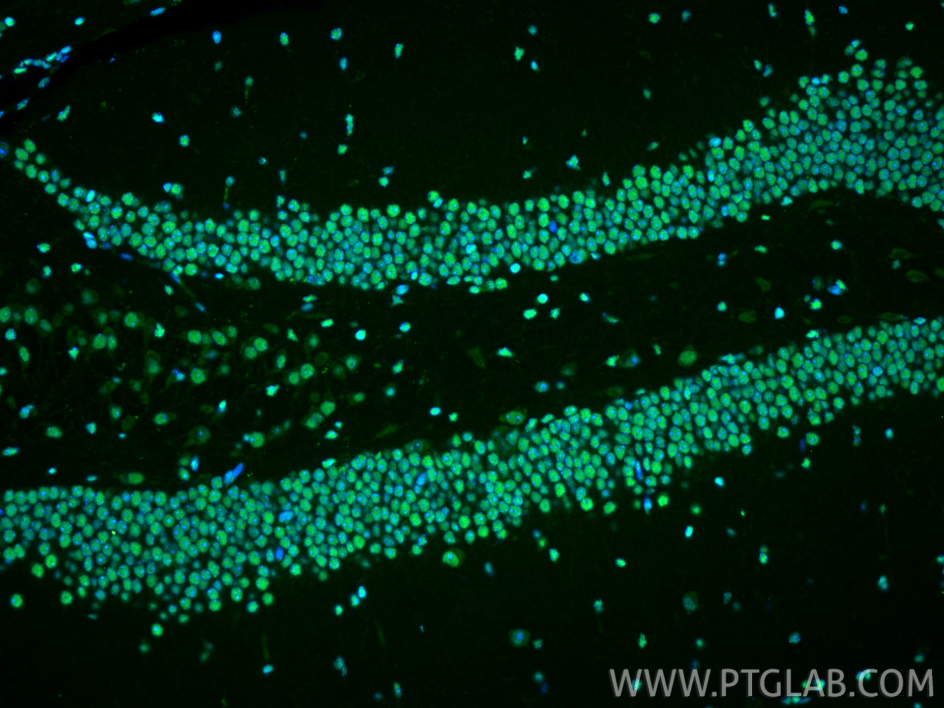 Immunofluorescence (IF) / fluorescent staining of mouse brain tissue using HMGB1 Polyclonal antibody (10829-1-AP)