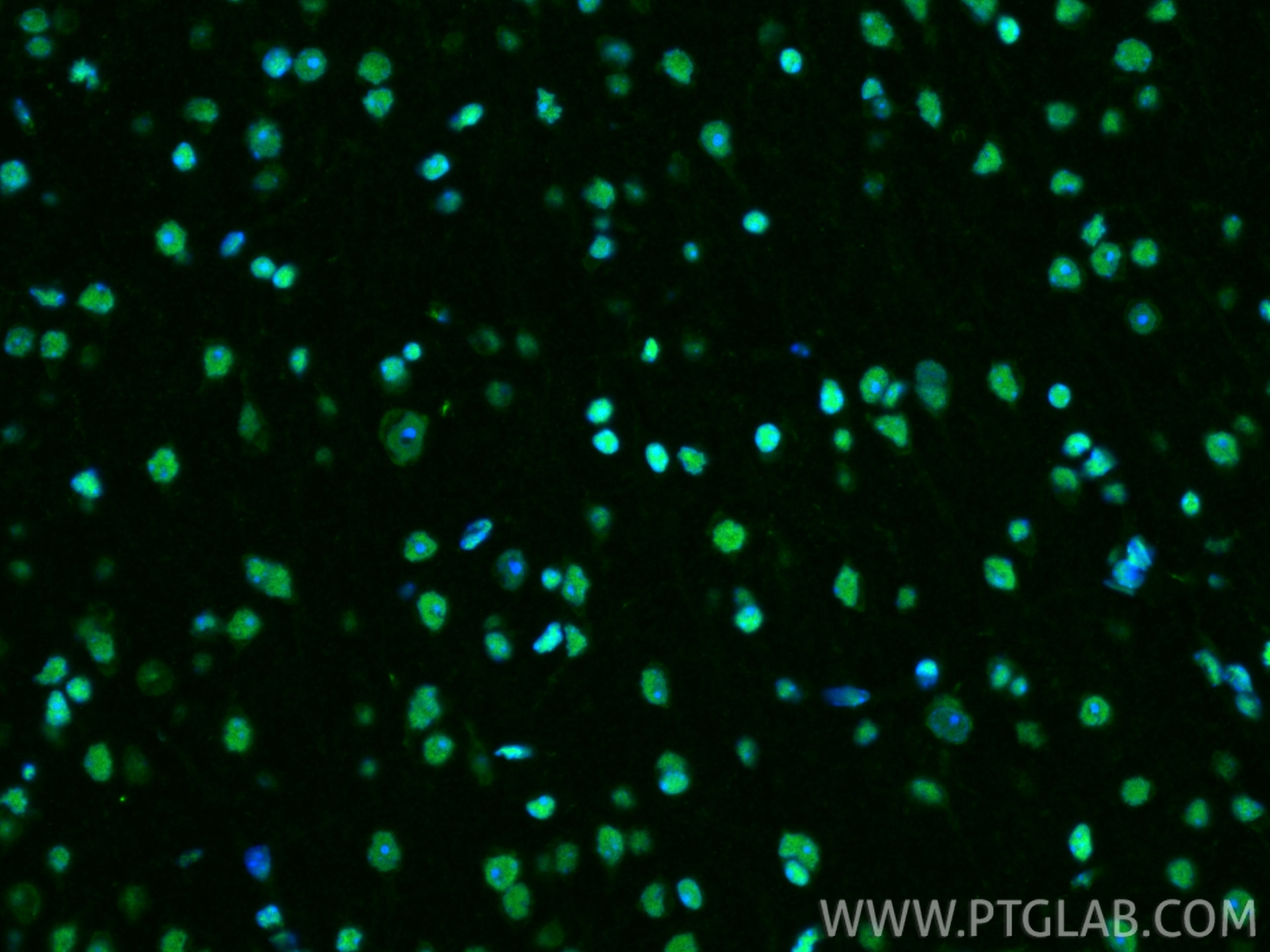 Immunofluorescence (IF) / fluorescent staining of mouse brain tissue using HMGB1 Polyclonal antibody (10829-1-AP)