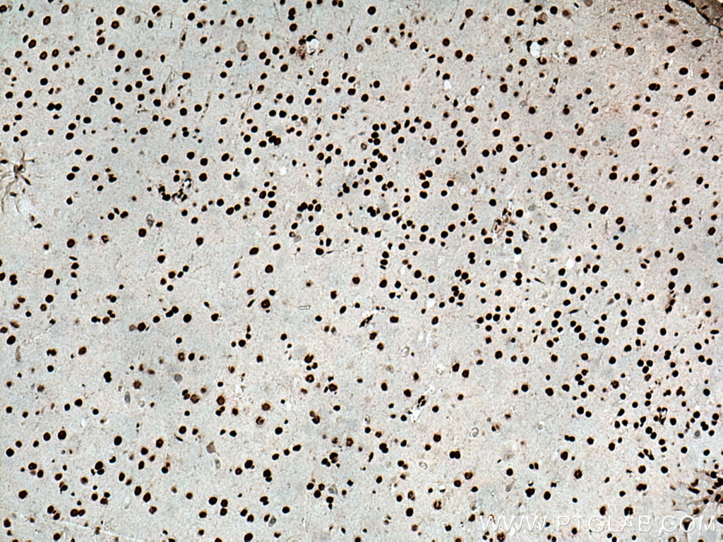 Immunohistochemistry (IHC) staining of mouse brain tissue using HMGB1 Polyclonal antibody (10829-1-AP)