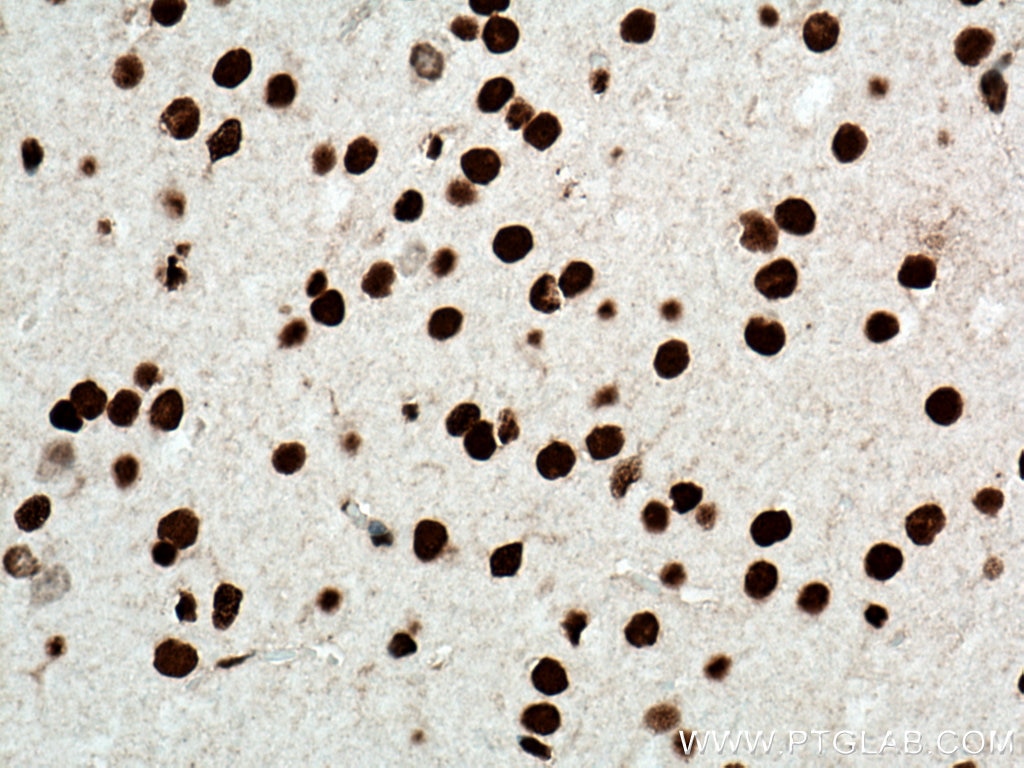 Immunohistochemistry (IHC) staining of mouse brain tissue using HMGB1 Polyclonal antibody (10829-1-AP)