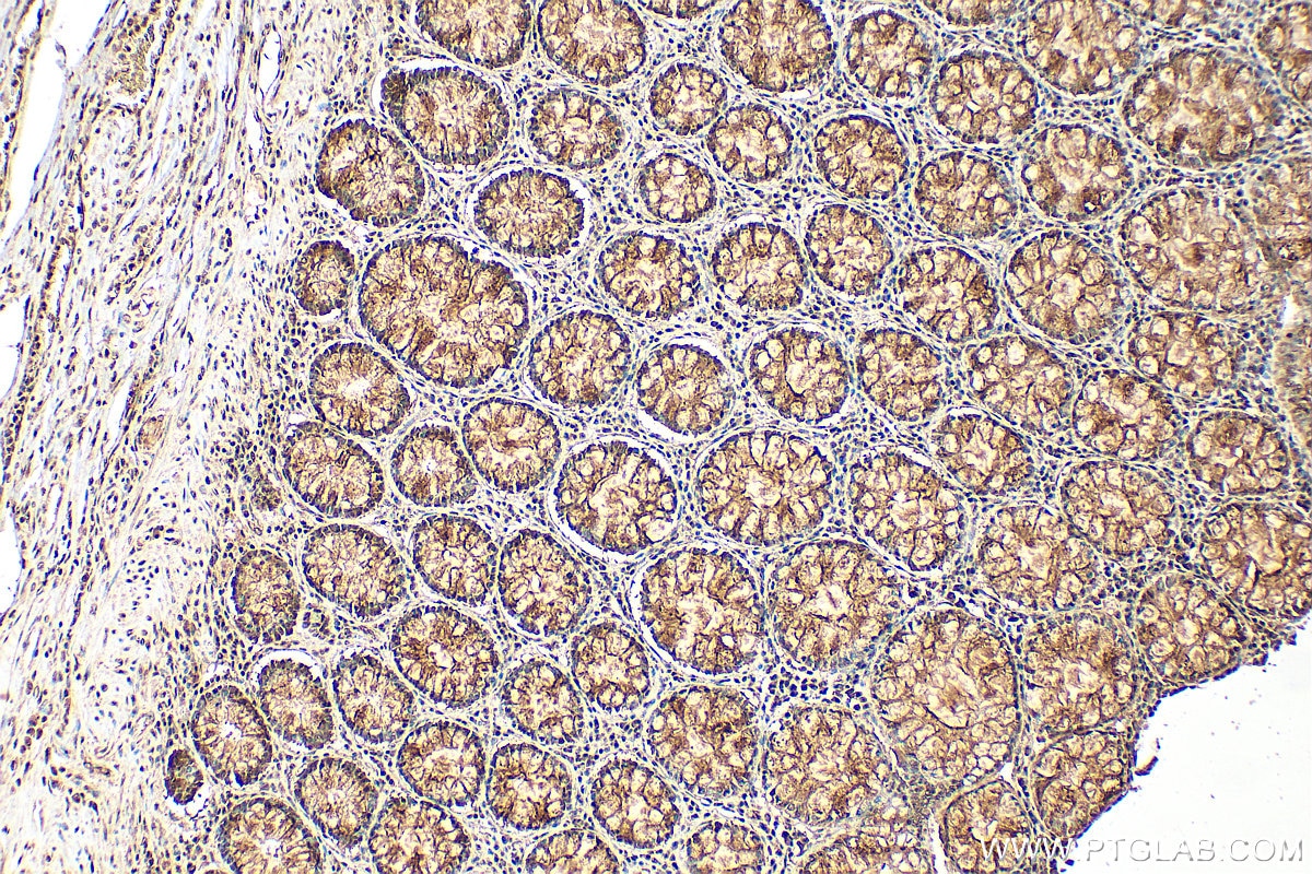IHC staining of human colon using 10829-1-AP Immunohistochemistry (IHC) staining of human colon tissue using HMGB1 Polyclonal antibody (10829-1-AP)