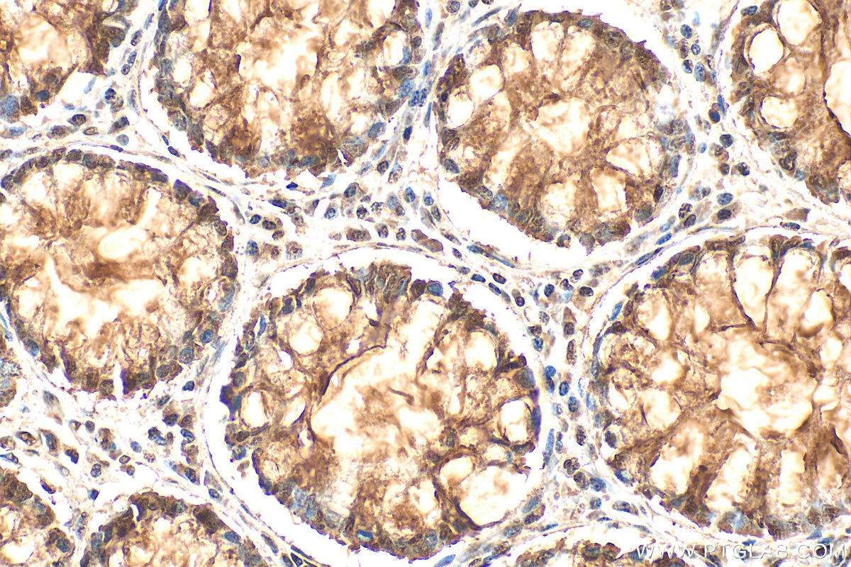 IHC staining of human colon using 10829-1-AP Immunohistochemistry (IHC) staining of human colon tissue using HMGB1 Polyclonal antibody (10829-1-AP)
